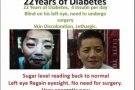 !!! 糖尿病可以治愈 !!! Diabetes Can Be Cure!!!